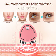 Load image into Gallery viewer, Luxe Skin™ - Microcurrent Lifting Device
